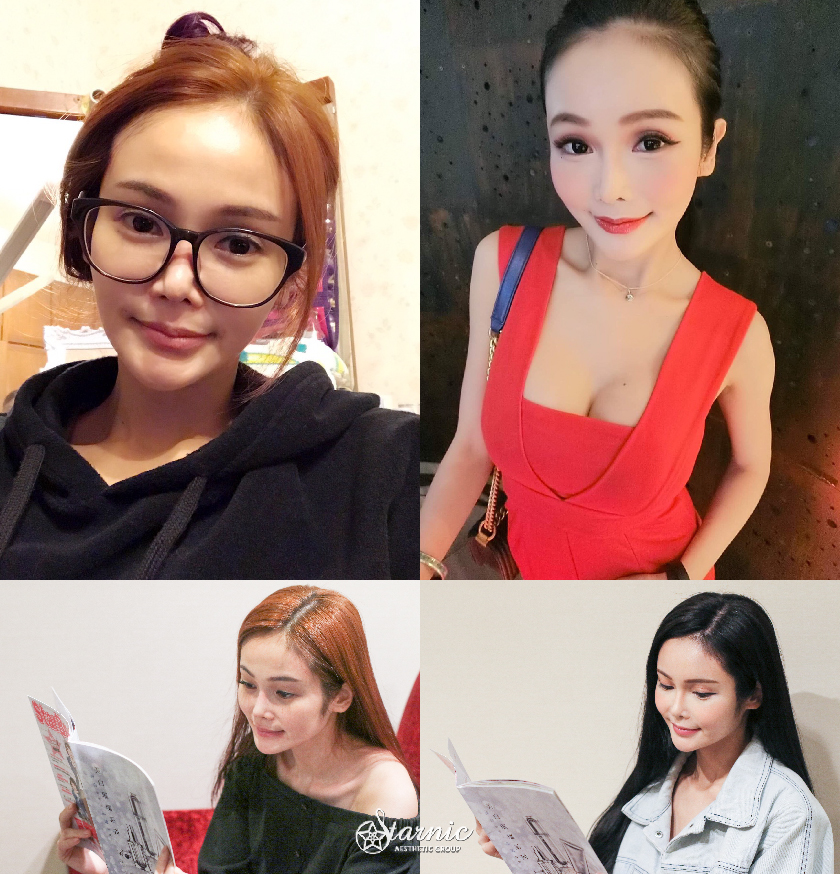 星采大安_骨水泥豐額_LingLing 01