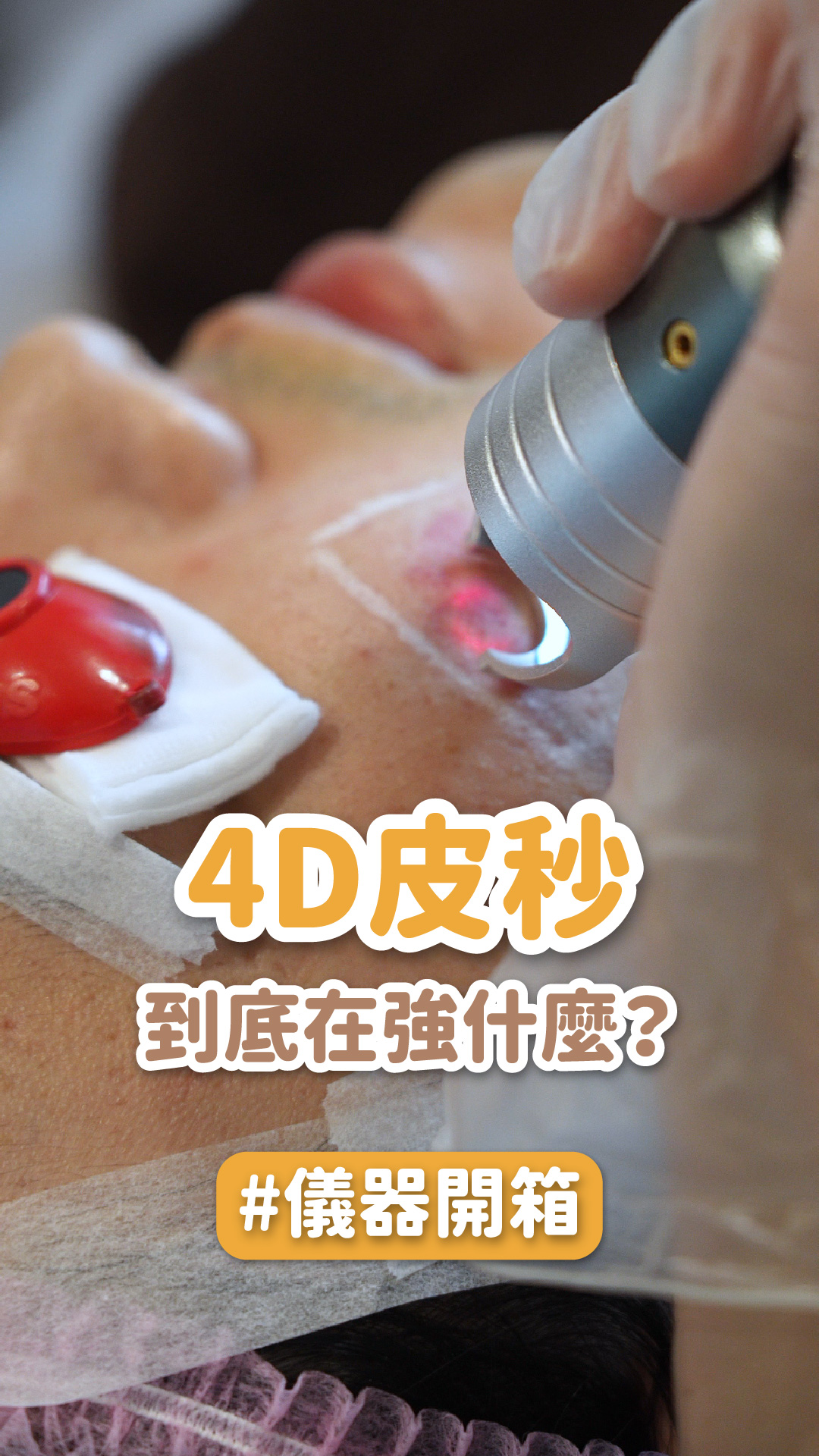 【修秘皮秒】4D皮秒到底在強什麼？一次講清楚