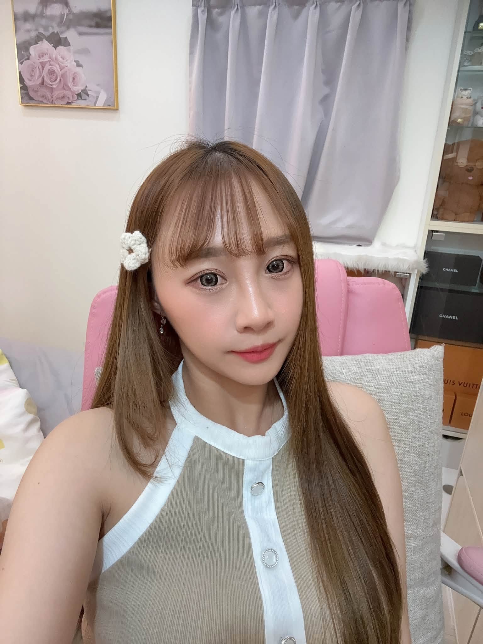 【皮秒雷射】星和診所（台南）-陳韋明醫師-真的太感動了！ 看到最近的黑眼圈改善這麼多，心情整個特開心- 姜沛瑜