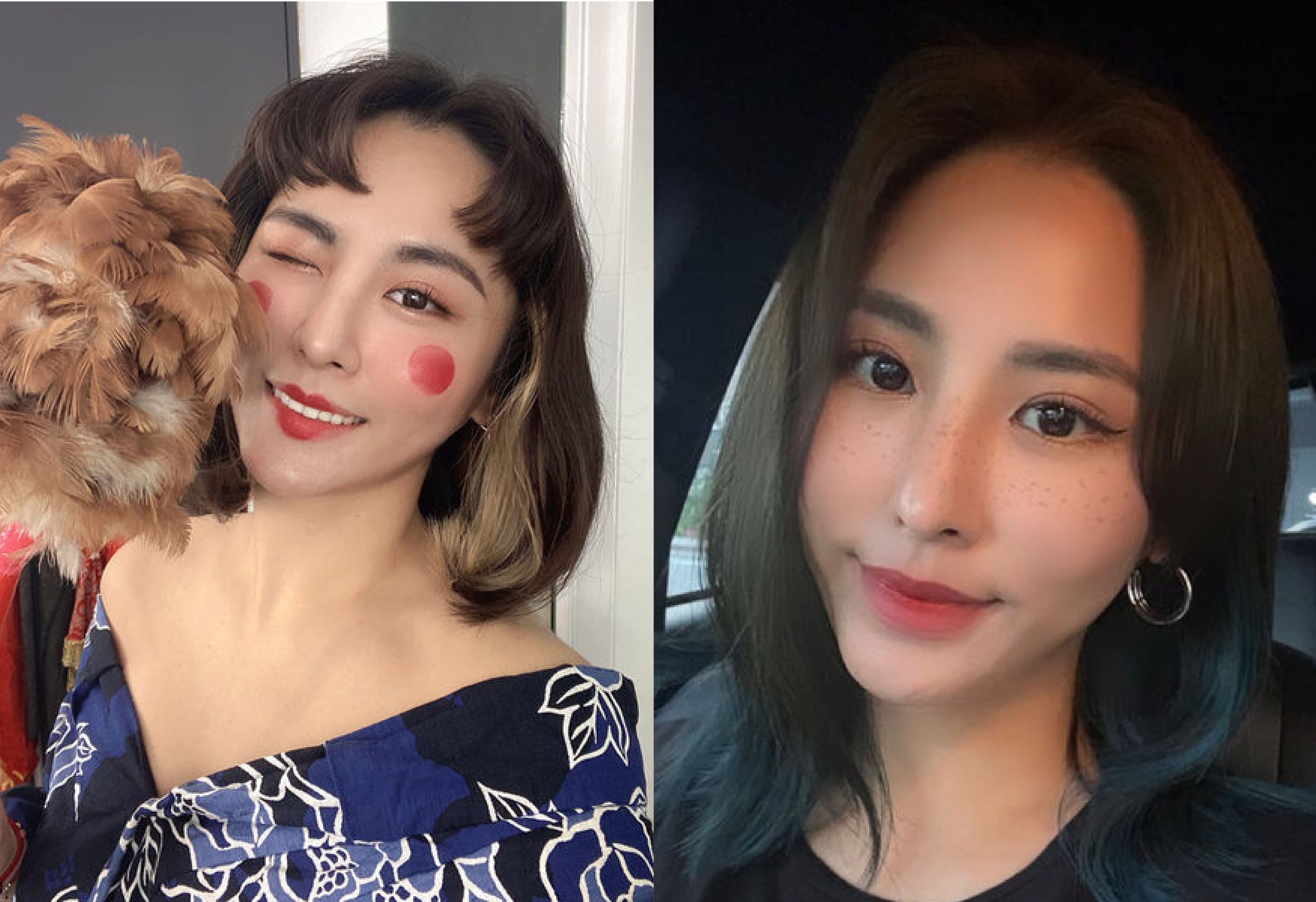 肉毒瘦小臉 星和診所 板橋醫美 王善民醫師 矯正咀嚼肌 定期放鬆瘦臉技 Demi 萬人好評