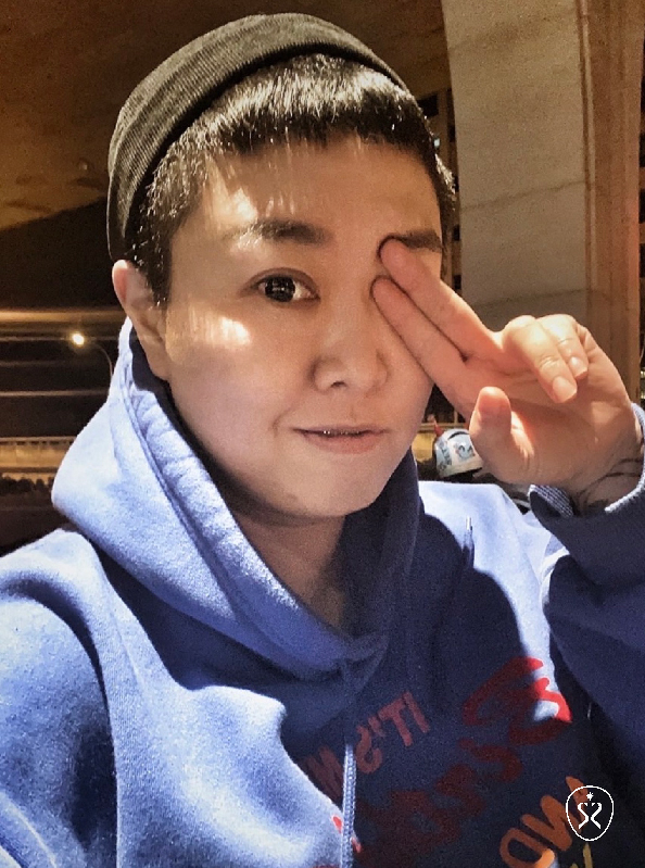 玻尿酸隆鼻 星和診所 台中醫美 陳毅修醫師 山根挺起來 就像換了張臉 寶豬 萬人好評