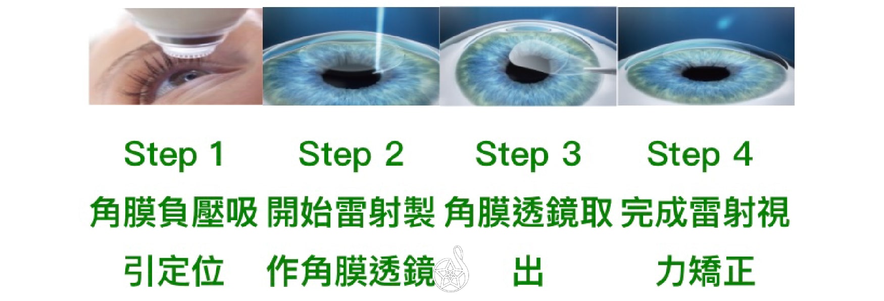 Smile全飛秒近視雷射 星和遠見雷射中心 張聰麒醫師 絕不後悔的近視雷射 不用再花大筆費用買隱形眼鏡和藥水啦 上 萬人好評