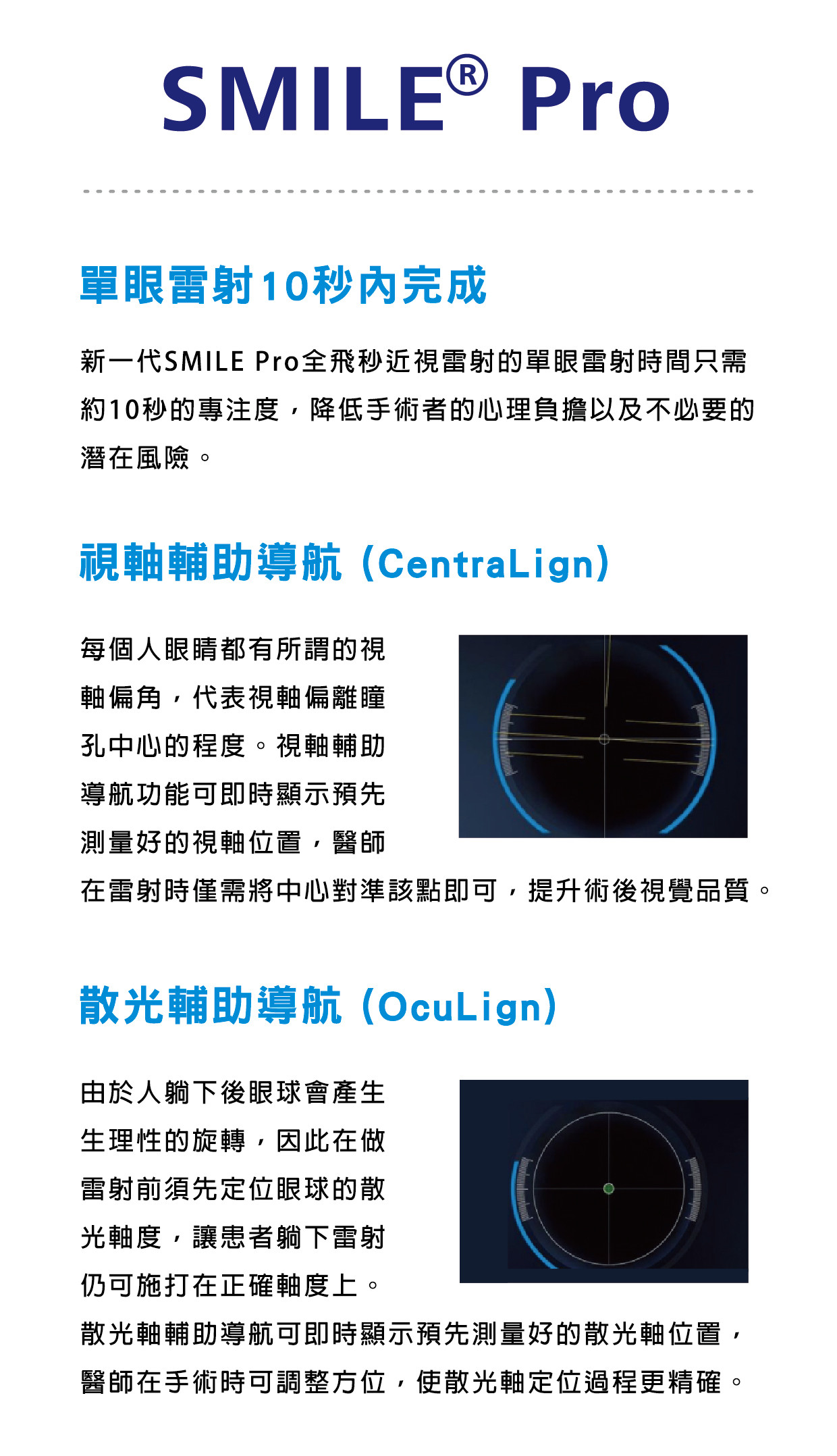 SMILE Pro 新一代德國微創近視雷射｜澄清眼科 服務項目