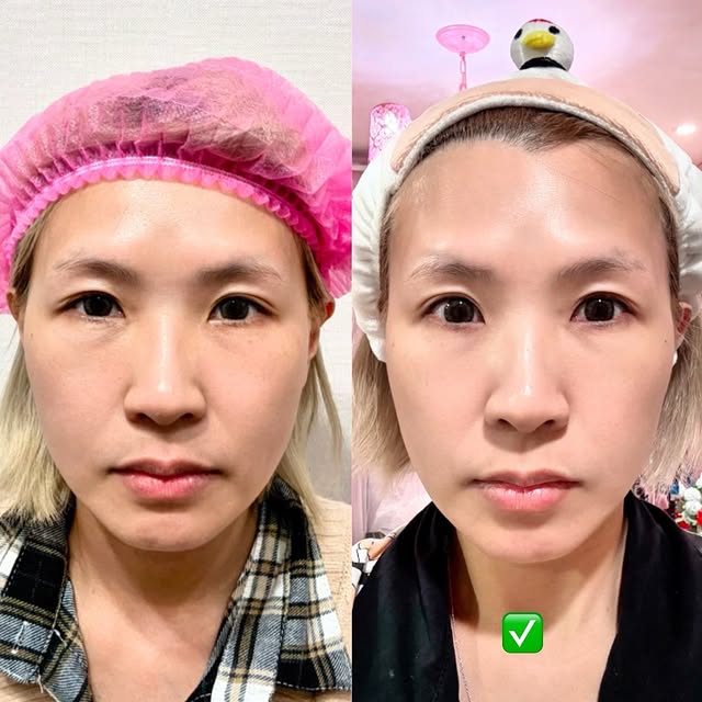 特別感謝星采星和醫美劉恭志醫師，讓我有了一次安心又愉快的療程體驗