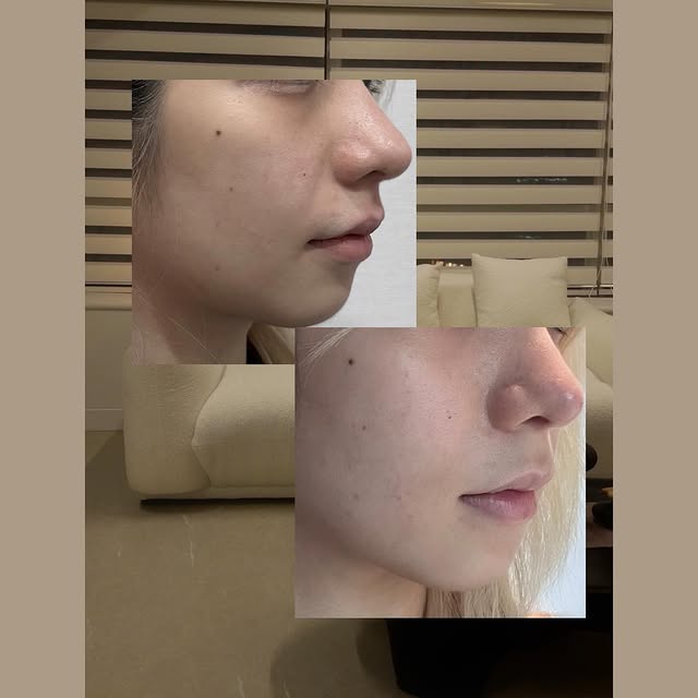 膚色不均暗沉的的人拜託去試
