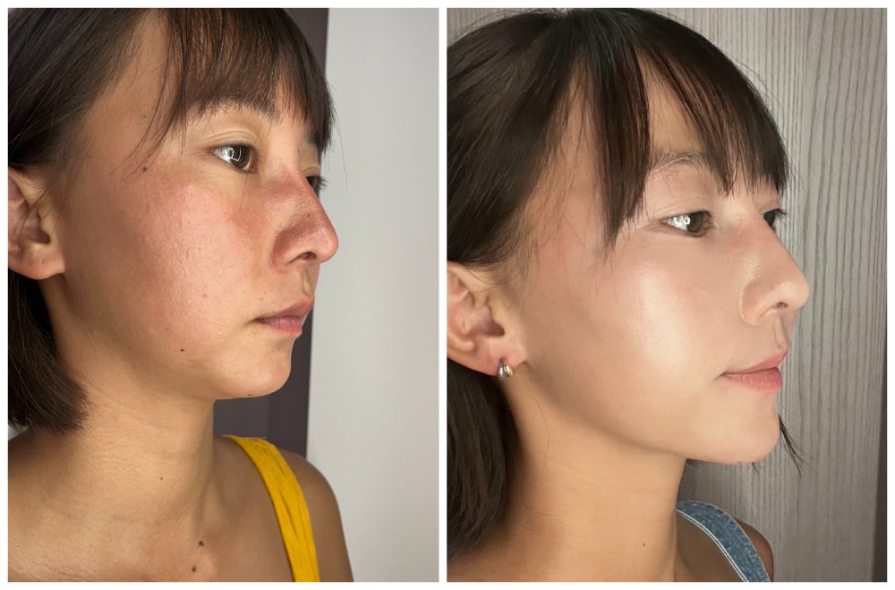 （音波可助於皮膚緊緻、拉提，圖片來源：Greta 林昱綺）