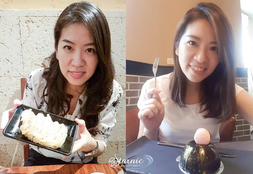 星和診所_Ulthera優珊納極線音波_張寒貞