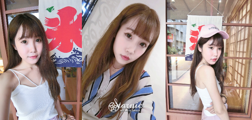 星和診所_肉毒瘦小臉_曾鈺婷