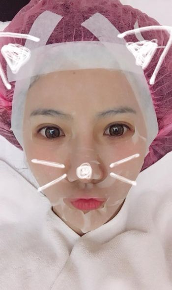【淨膚雷射】失眠臉色超暗沉快來淨膚雷射