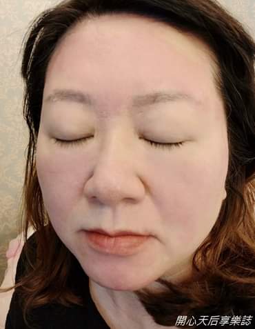 【飛梭雷射】  最近鼻頭毛孔粗大到礙眼又會卡粉，這個月打「飛梭雷射」！！～-開心天后享樂誌