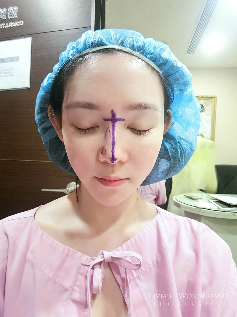 描述: https://1.bp.blogspot.com/-MdAhL2-eDwI/YTi2oQm92BI/AAAAAAABdBE/igCLfWXvuoghDzkCbEsLg2Z1skC2WpSGgCPcBGAsYHg/s0/Rhinoplasty-01.jpg