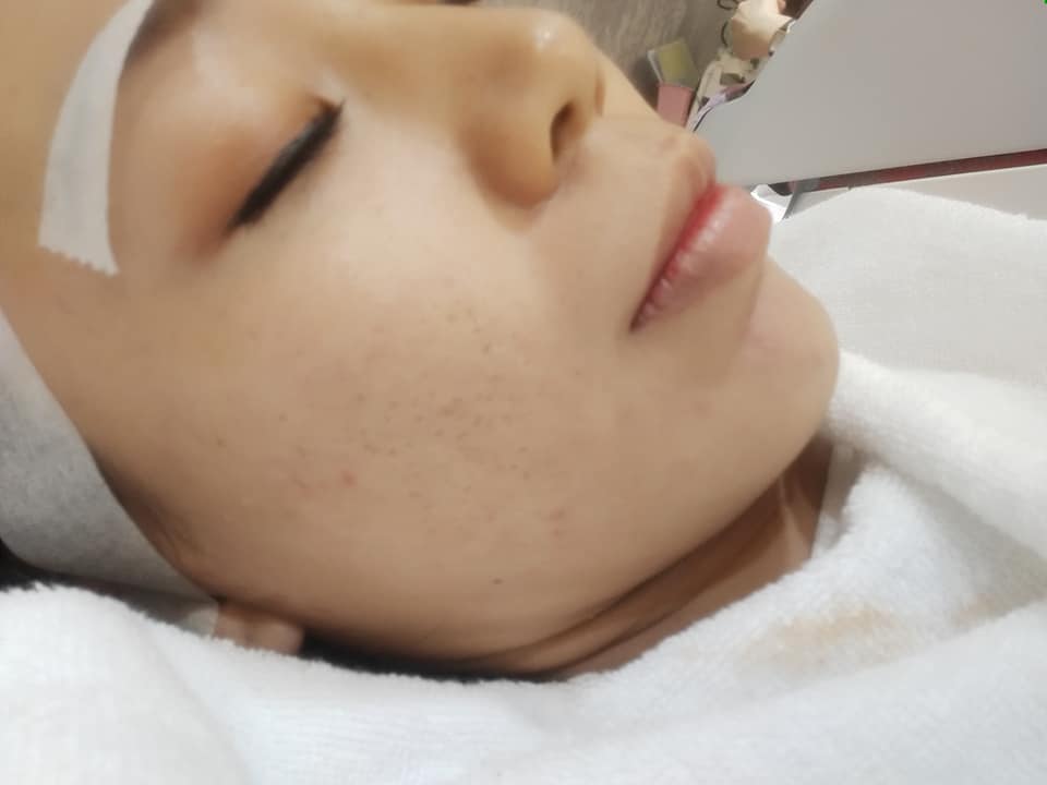 【皮秒雷射】星和診所-高雄市 賴衍翰醫師-皮秒雷射亮白系列,給你皮膚光滑細緻-E girl 小依