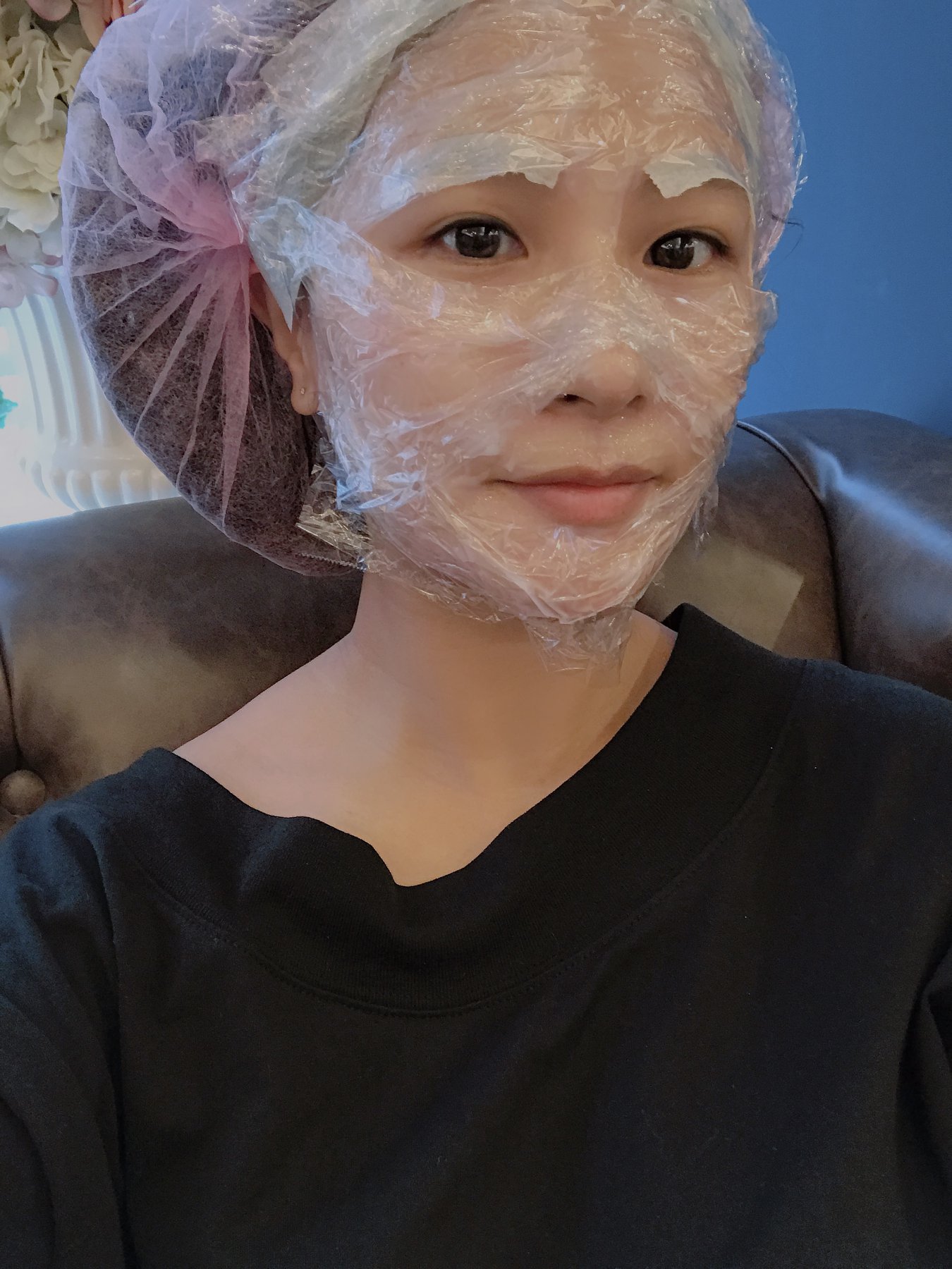 【皮秒雷射】仁愛星和診所-打過皮秒後的皮膚 怎麼拍臉都很亮啊!~_雪拼女皇