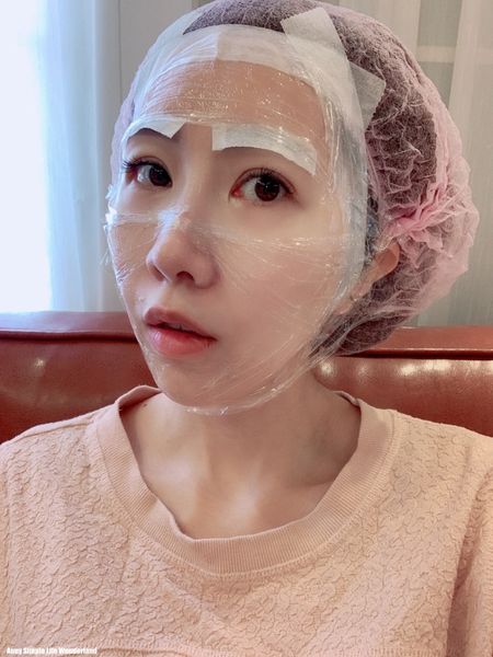 【皮秒雷射】愛上皮秒雷射術後嫩透白的肌膚