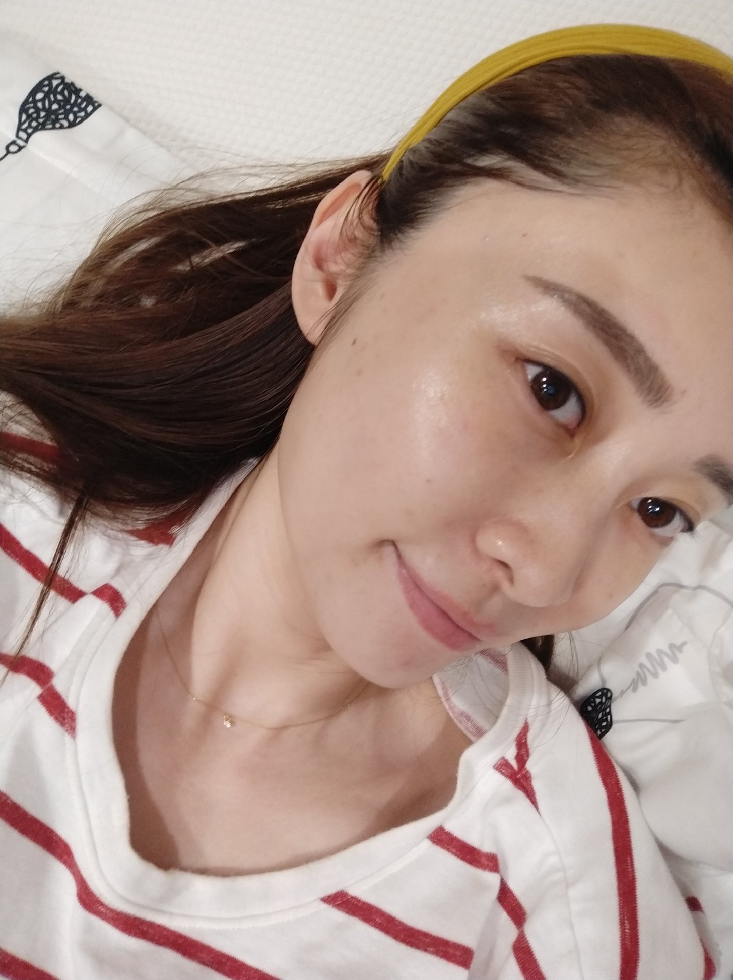 【皮秒雷射】星采整形外科診所(大安)-讓肌膚自帶女神光_Moon沐木