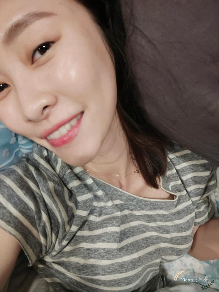 【玻尿酸】星采整形外科診所(大安)-真的想要肌膚好保養不可少！_Moon沐木