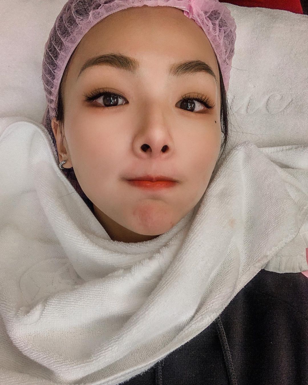 【彩衝光】星采整形外科診所(大安)-亂長痘交給彩衝光-alison yeh