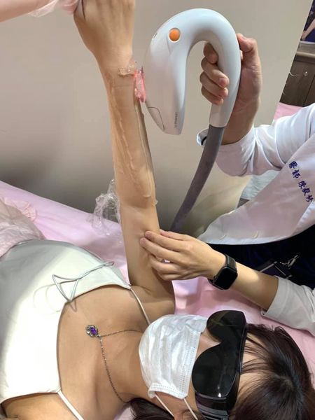 【雷射除毛】預計成為無毛人😍