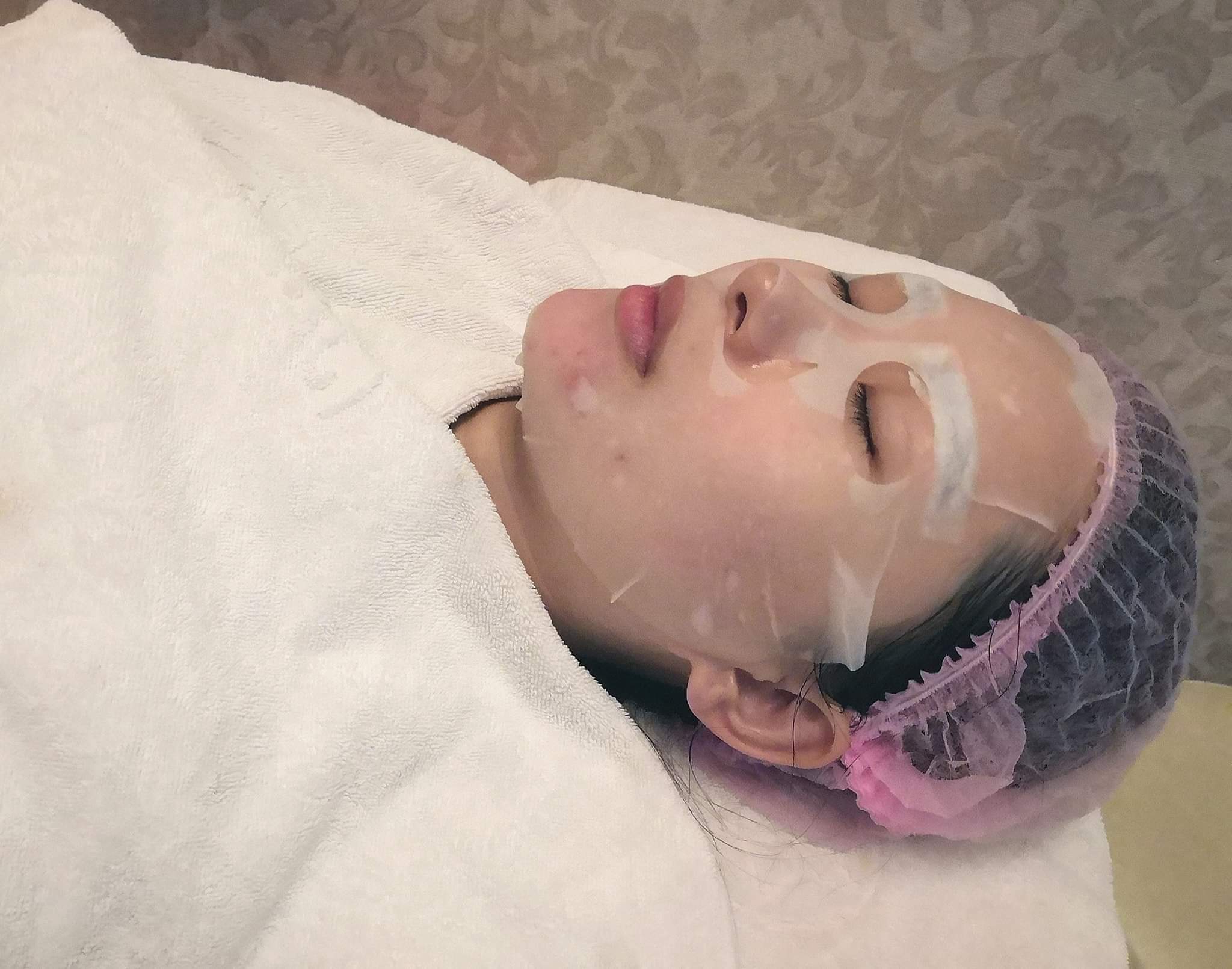 【杏仁酸煥膚】做完杏仁酸後，痘痘也都代謝出來了，超棒的啦～！～！！！ ~-Vanessa_小雨