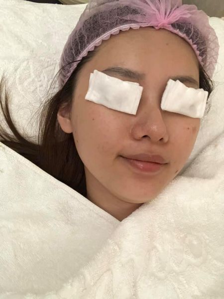  【杏仁酸】星和診所/台南醫美-維持肌膚健康-曉雅