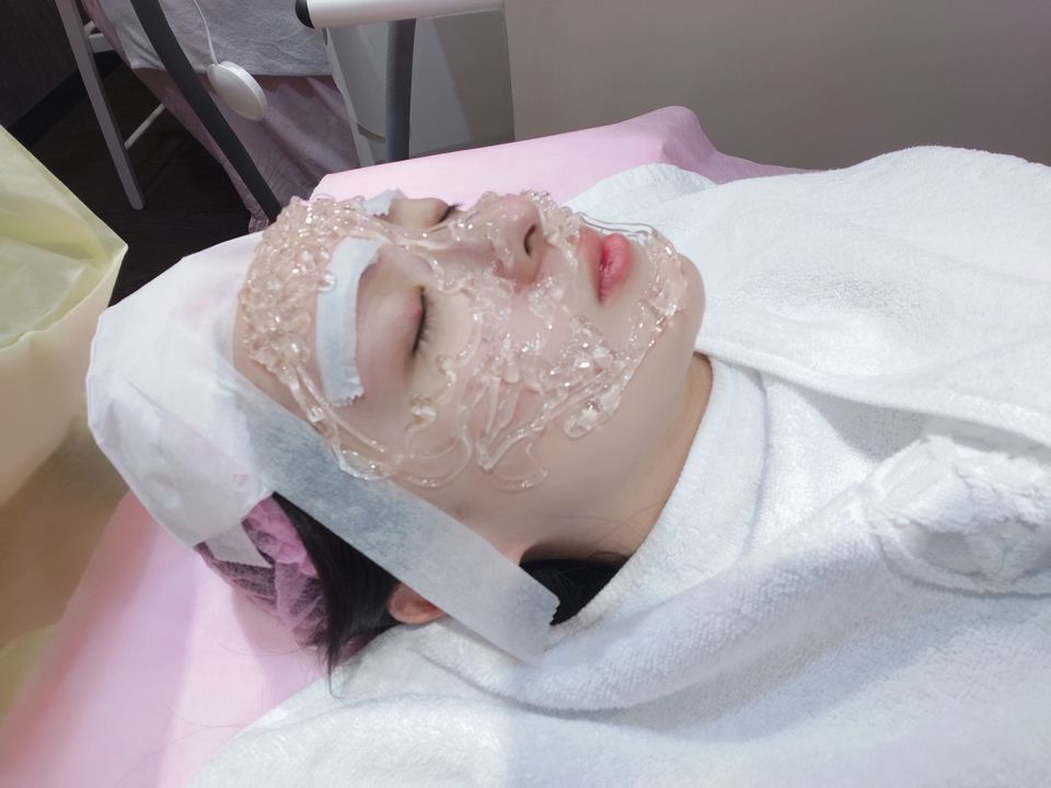 【彩衝光】星采整形外科診所-雀斑可以徹底掰掰-茉莉Moni