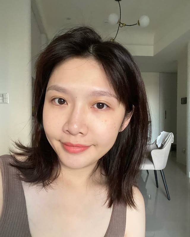 定期做水光針
