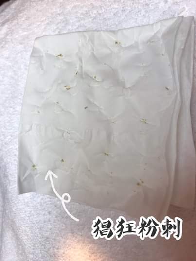 【杏仁酸煥膚】杏仁酸深層淨化角質，和粉刺痘痘說掰掰 ❤❤！！！~-曾琬婷