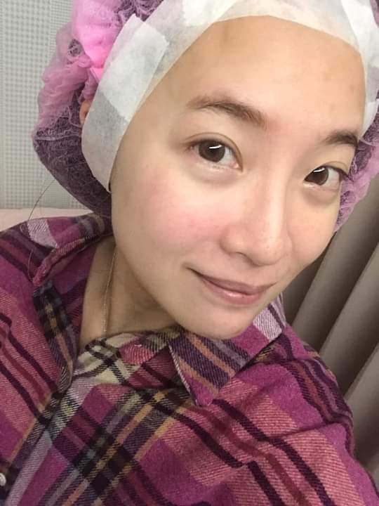 【淨膚雷射】星和診所/台北醫美-定期保養進廠維修，擺脫擾人斑紋 ！！～-Angel.安啾啾