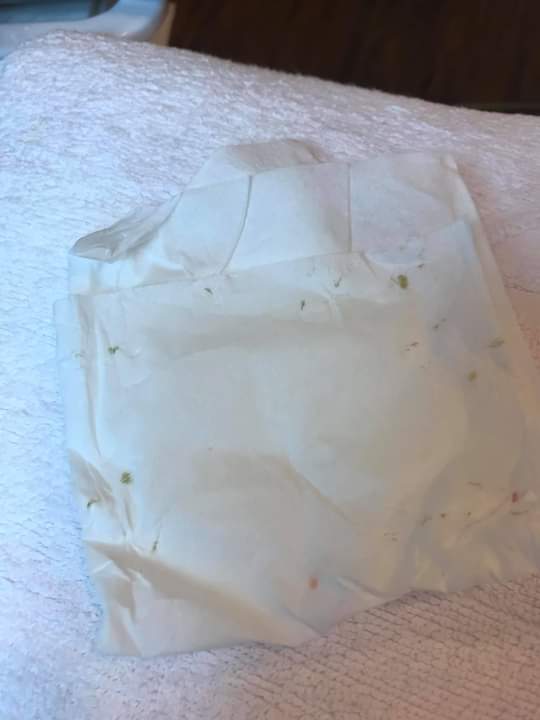 【杏仁酸煥膚】杏仁酸深層淨化角質，提升真皮層保水度，溫和的無負擔保養，是創造好膚質的第一步❤❤！！！~-曾琬婷