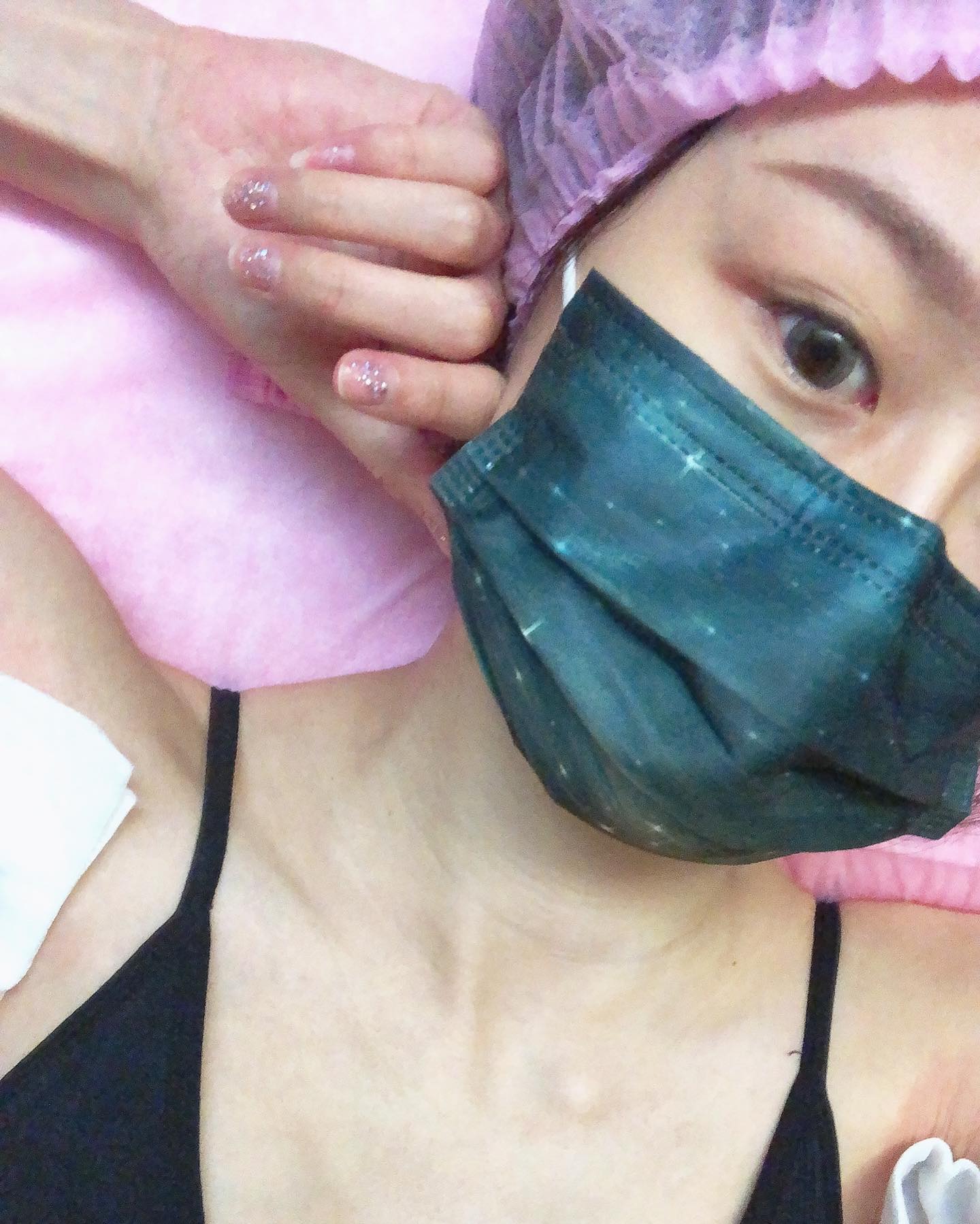 【雷射除毛】星和診所(古亭)-讓腋毛越長越慢、越來越少!_Doris 朵樂