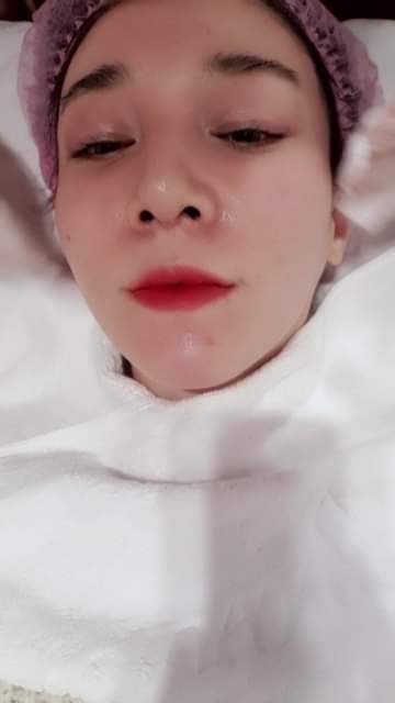 【杏仁酸煥膚】過新年，皮膚也要煥然一新，皮膚也要大掃除一下❤❤！！！~-Yu Chang