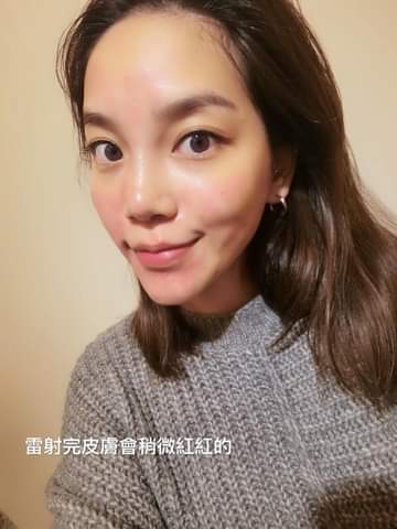 【皮秒雷射】仁愛星和診所/東區醫美對於改善肌膚雀斑、刺青、疤痕、暗沉非常有效哦！-Muse x 陳彤彤