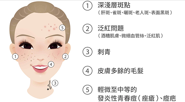 【夫妻♥保養】皮秒雷射：中年人重拾青春的秘密武器！