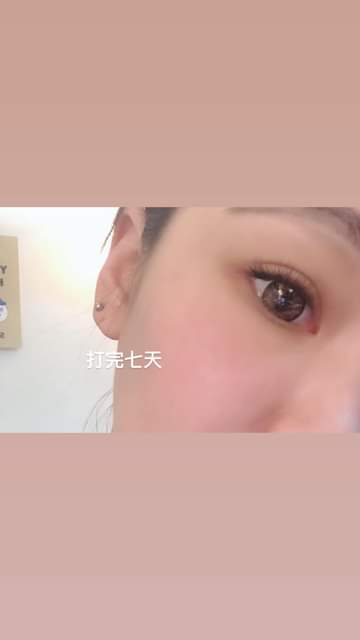  【皮秒雷射】星和診所（新竹）-陳明如醫師-標題-Ricole