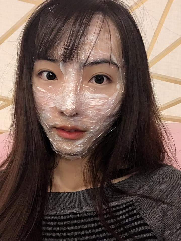 【飛梭雷射】 素顏來打久違的飛梭～雷射痘疤希望有朝一日我可以不開美肌皮膚也能很漂亮～-佳蕙的生活日記