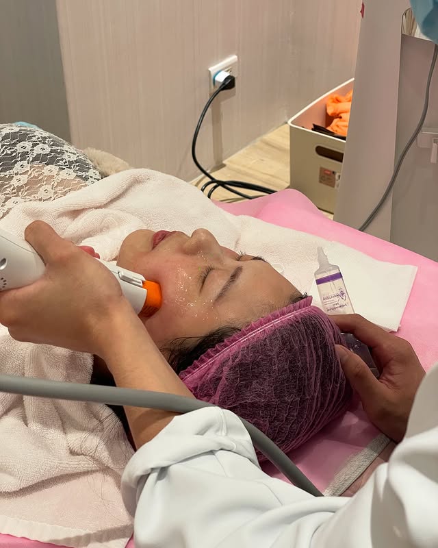 玩美電波幾乎沒有恢復期，療程約一小時！