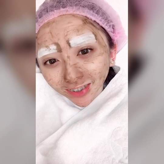 【杏仁酸煥膚】 前陣子長痘痘留了一些痘疤，進廠保養，上妝後妝感也變服貼了❤❤ ~-李宜融