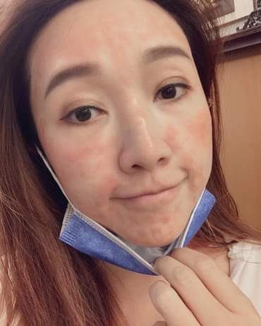 【皮秒雷射】仁愛星和診所/東區醫美 沒有醜女人只有懶女人 -PHAT G 恬寶