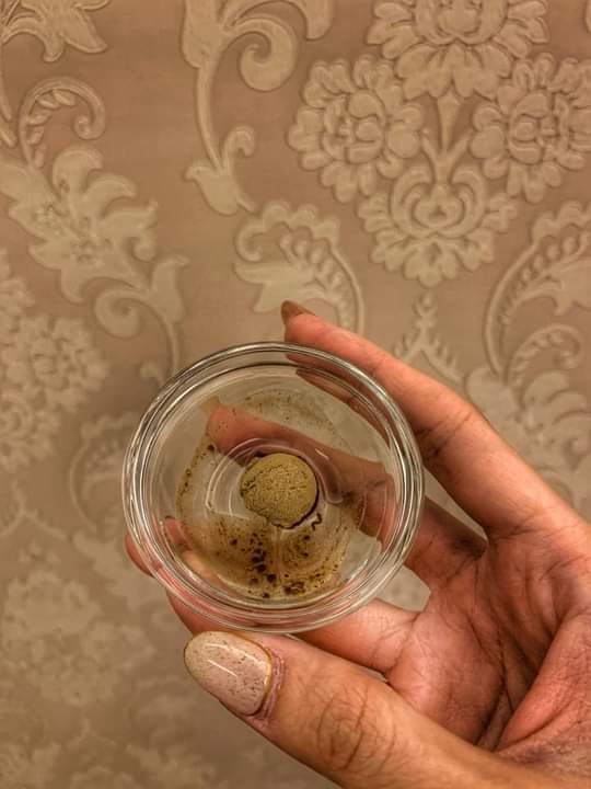 【杏仁酸煥膚】 效果意外的好，皮膚整個非常的透亮，非常的滿意❤❤ ~-邱詩媛