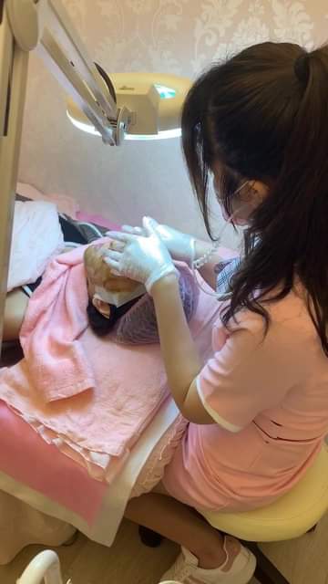 【杏仁酸煥膚】改善問題肌.改善膚色不均困擾，和痘痘說掰掰！～❤❤！！！-馮苡珺