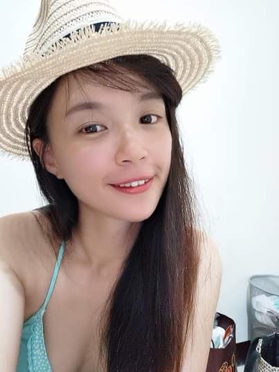 【晶亮瓷】 膠原蛋白增生的效果讓蘋果肌變得更澎潤，看起來氣色較好、膚質也變得更緊緻光滑！～-吳乙秦