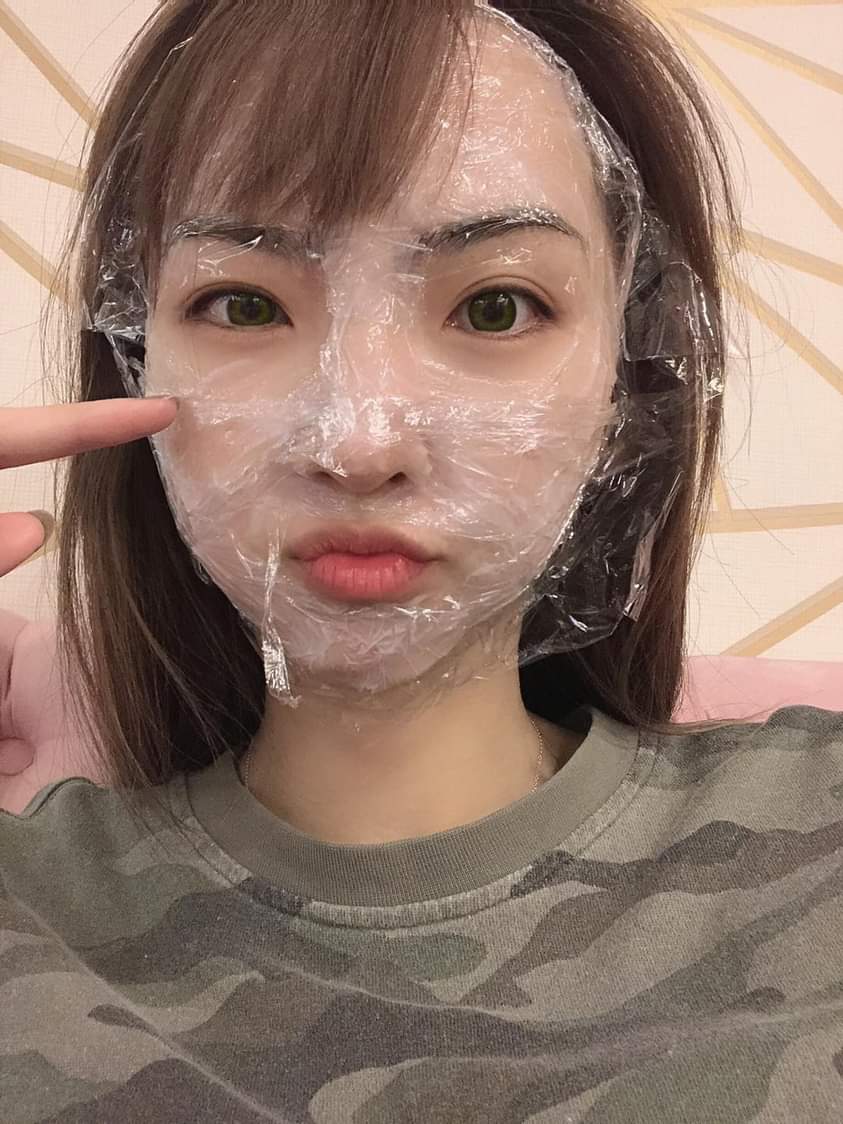 【飛梭雷射】今天是睽違一年再度挑戰飛梭雷射除痘疤，果然還是超級痛啊啊啊 ~但痛是值得的！！～-佳蕙的生活日記