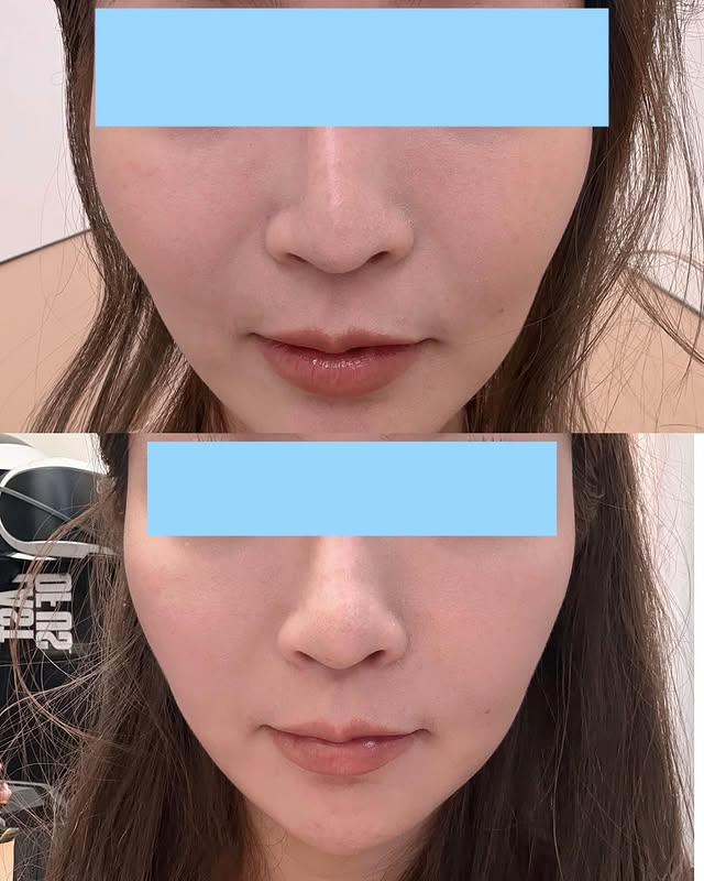 來看看比對圖