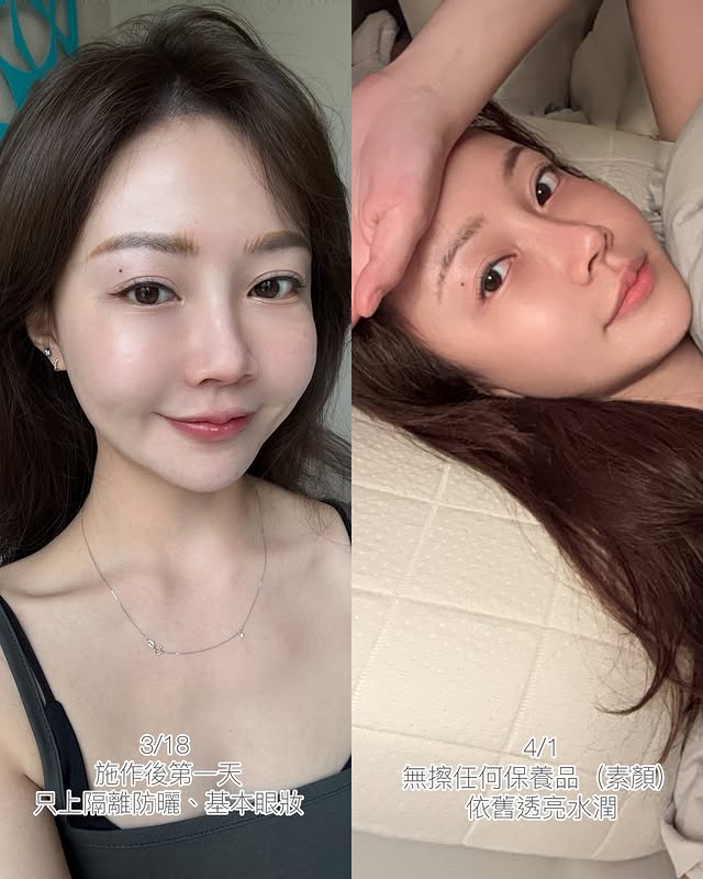 經歷一個月的肌膚變得更穩定、滑嫩亮、毛孔緊緻