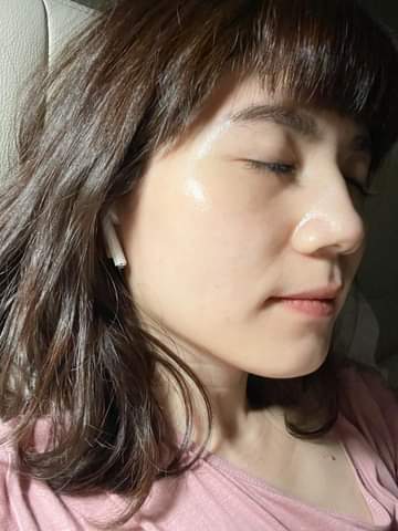  【皮秒雷射】星和診所/北車醫美 皮秒也是每個月都要對皮膚做保養-HERE 安九