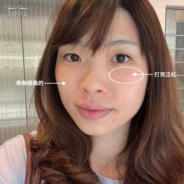 【皮秒雷射】星采整形外科診所/大安醫美-林主培醫師-但膚色不均的問題解決了，斑變少臉也變得更亮囉-Fan Fan 美好生活