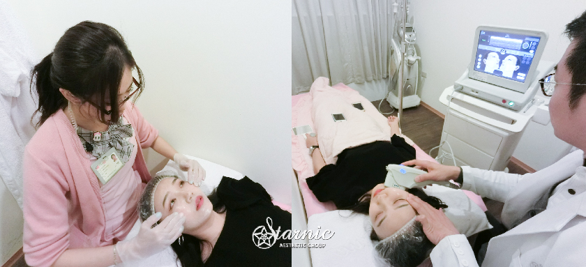 星和_Ulthera優珊納極線音波_蔡明薰04
