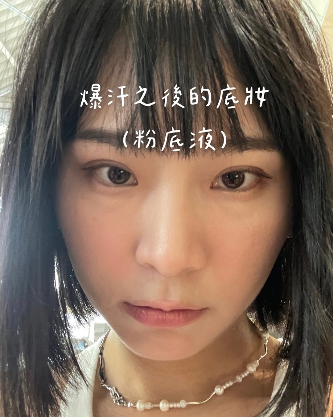自強星和診所（竹北）-水光注射(俗稱水光針)