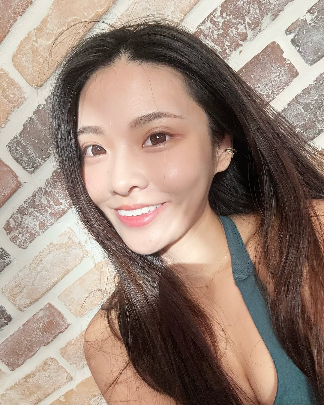 星采皮膚專科診所-皮秒雷射