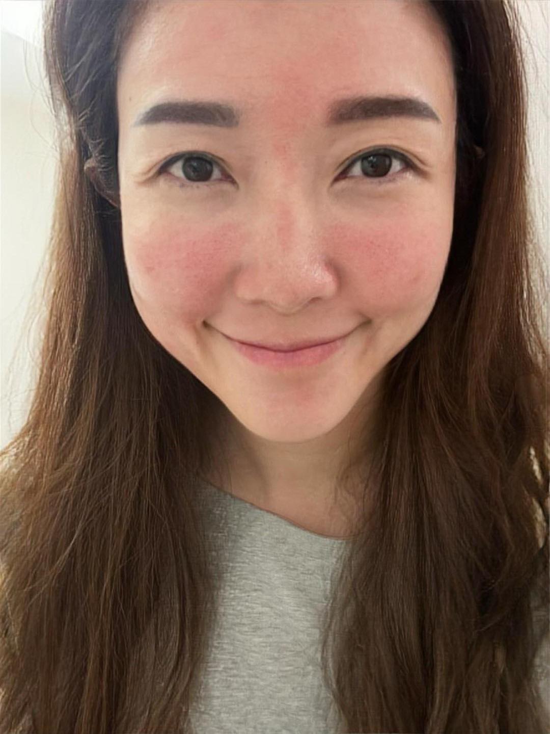 仁愛星和診所-皮秒雷射
